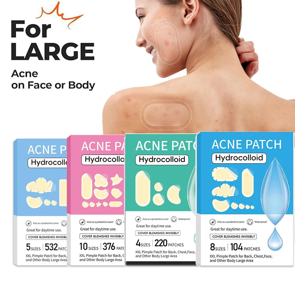 Large Pimple Patches Bulk for Face, 5 Sizes Hydrocolloid Acne Patches for Covering Body, Forehead, Chin Blemishes Zit Breakouts Oasis Select