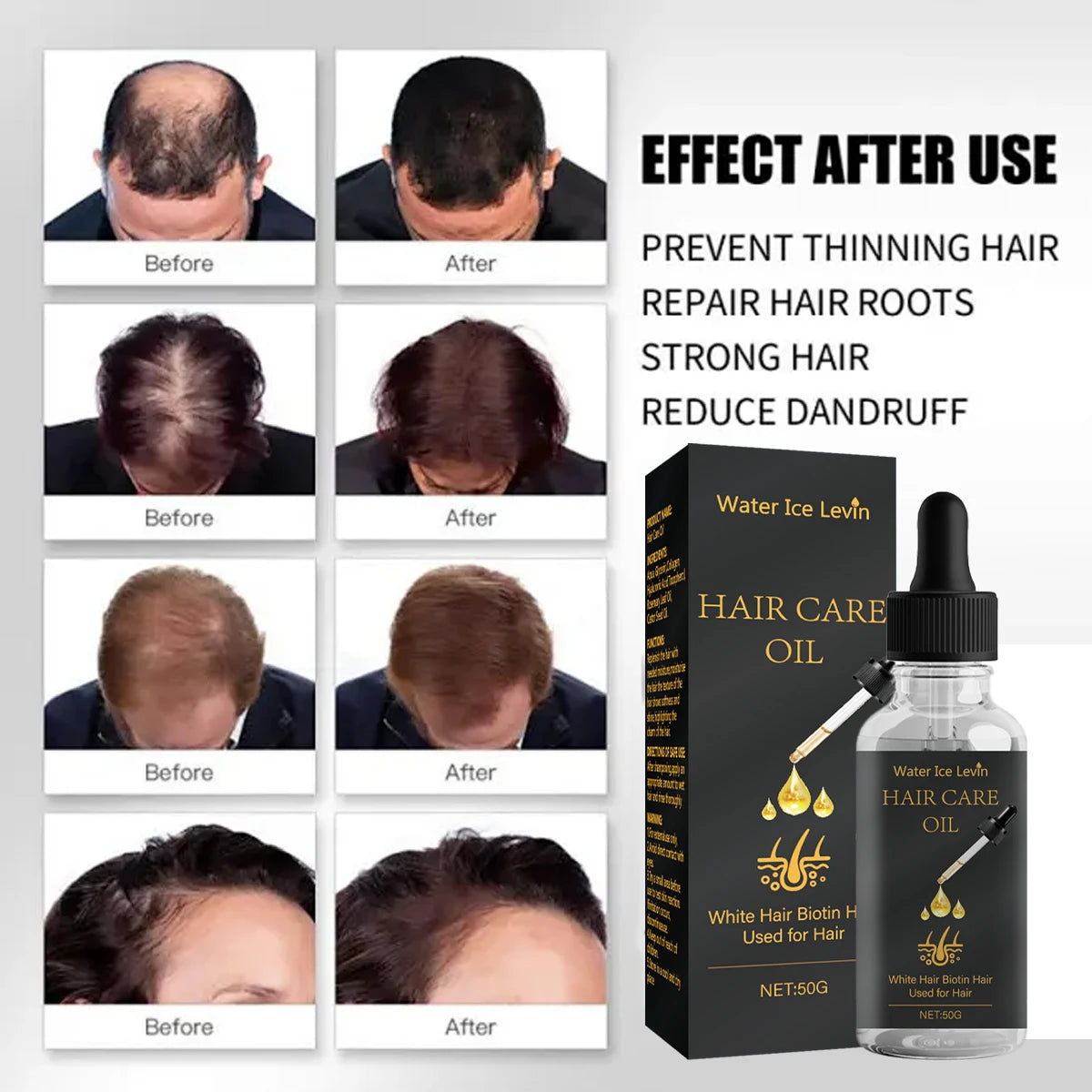 Biotin Hair Oil – Rosemary, Castor Oil & Collagen for Shine Hair Treatment Oil Oasis Select