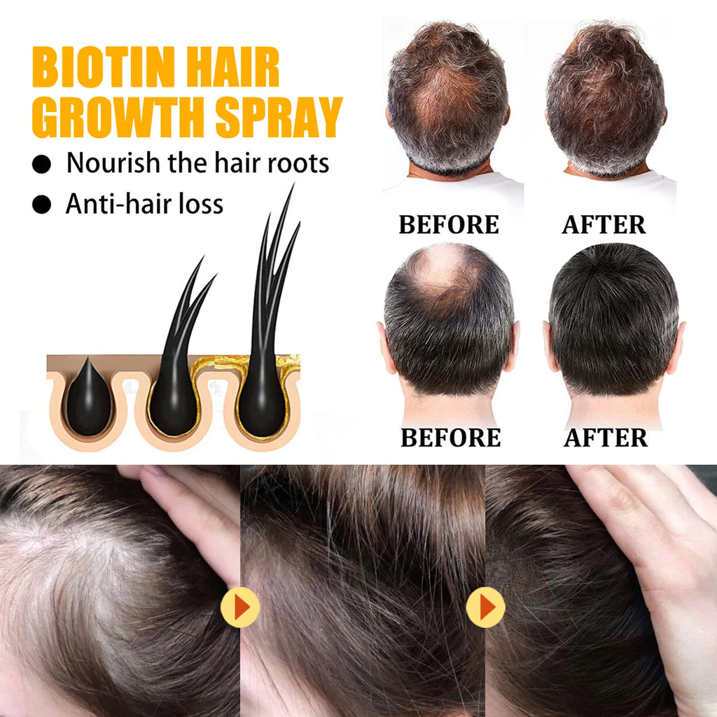 EELHOE Biotin Hair Spray For Man Women 30ml Hair Growth Repair Damage Restore Oil Scalp Repair Serum Spray Thicken Hair Care Oasis Select