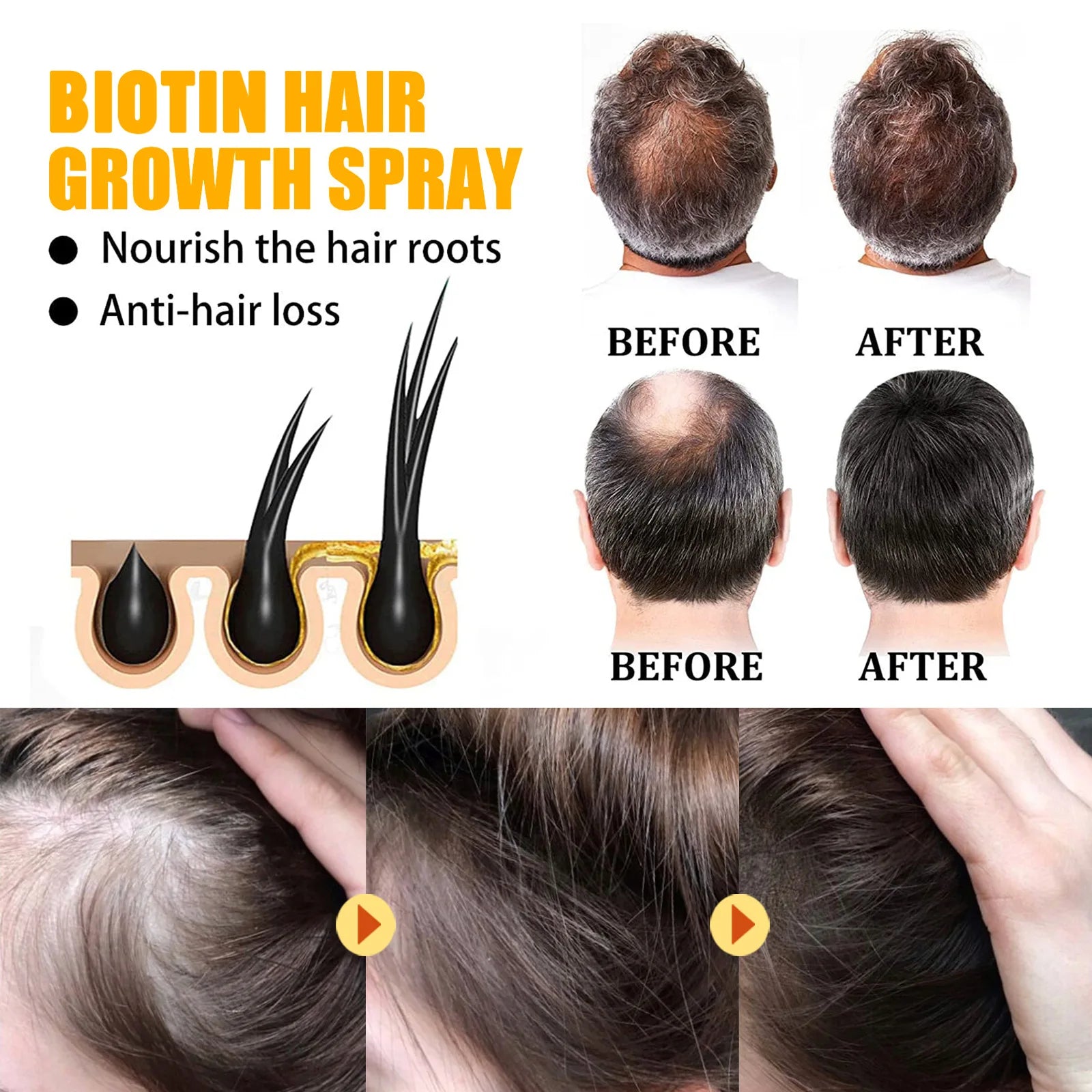 EELHOE Biotin Hair Spray For Man Women 30ml Hair Growth Repair Damage Restore Oil Scalp Repair Serum Spray Thicken Hair Care Oasis Select