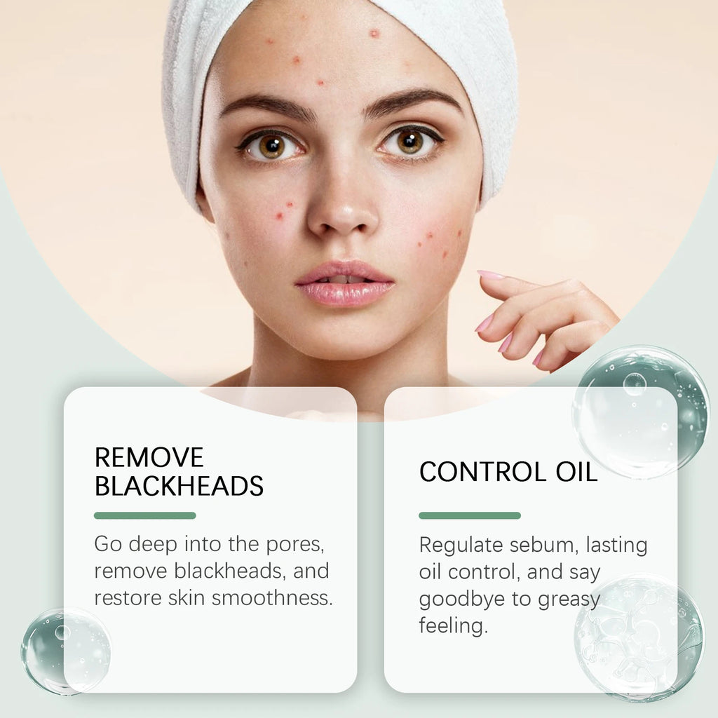 Hoygi Clay Mud Mask – Acne, Pores & Blackhead Remover Clay Mud Face Mask Oasis Select