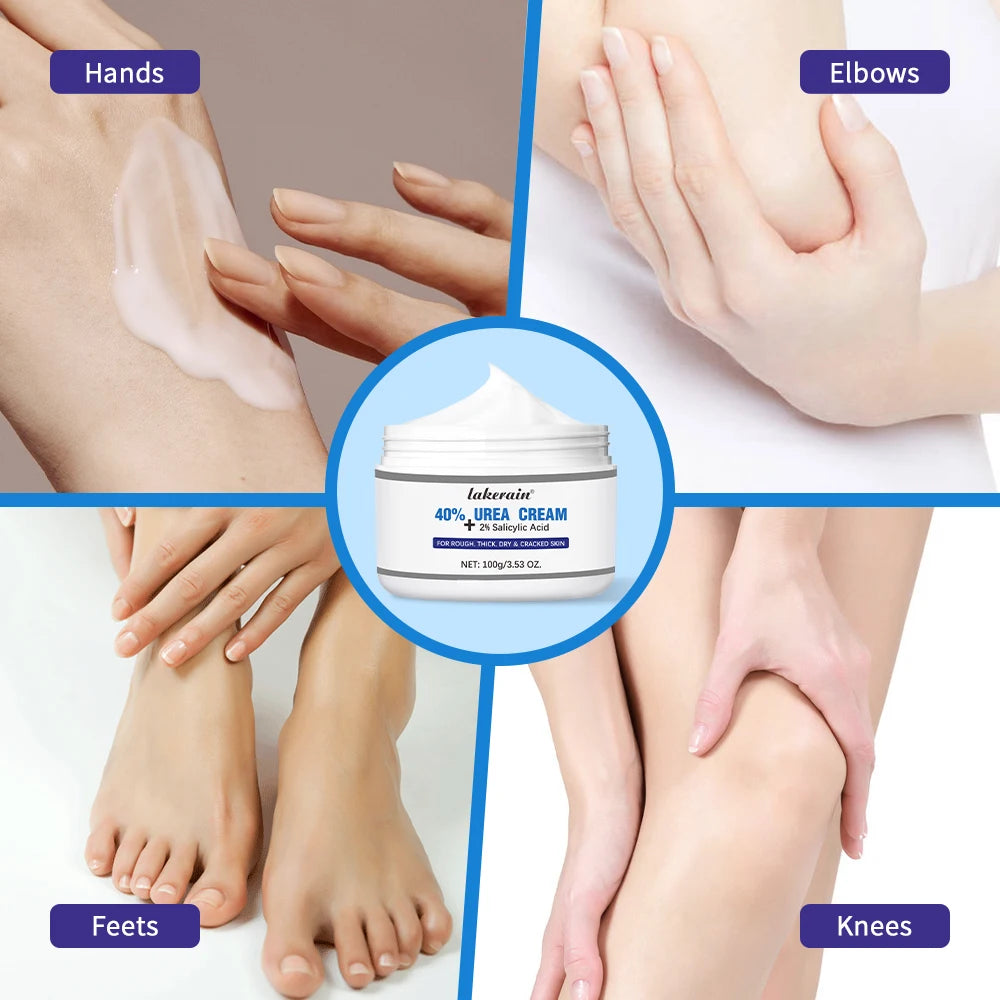 New 42% Urea Cream + 2% Salicylic acid Foot and hand Moisturizer, deep moisturizer and Nourishing moisturizer Oasis Select