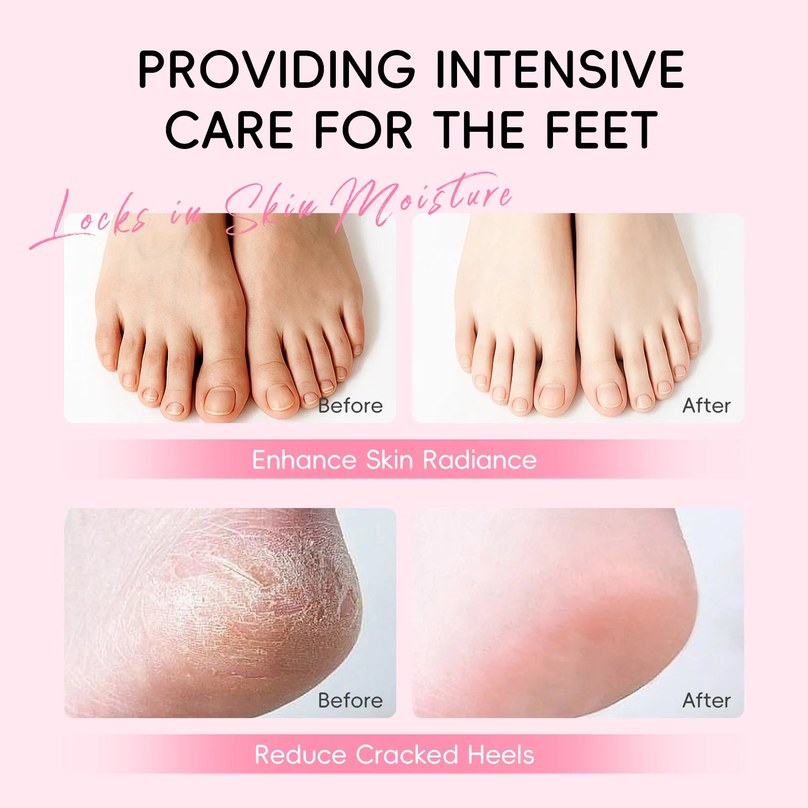 Foot Repair Stick 40g Callus Remover Deep Moisturizing for Cracked Heels Dry Dead Skin Removal Softens Rough Feet Home Care Oasis Select
