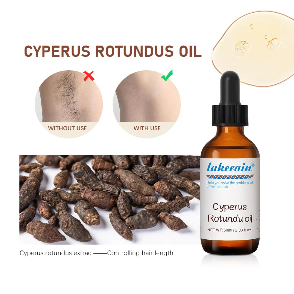 Semi-permanent Cyperus Rotundus Oil Hair Remover Armpit Legs Arms Hair Growth Inhibitor Beauty Skin Care Body Essential Oil Oasis Select