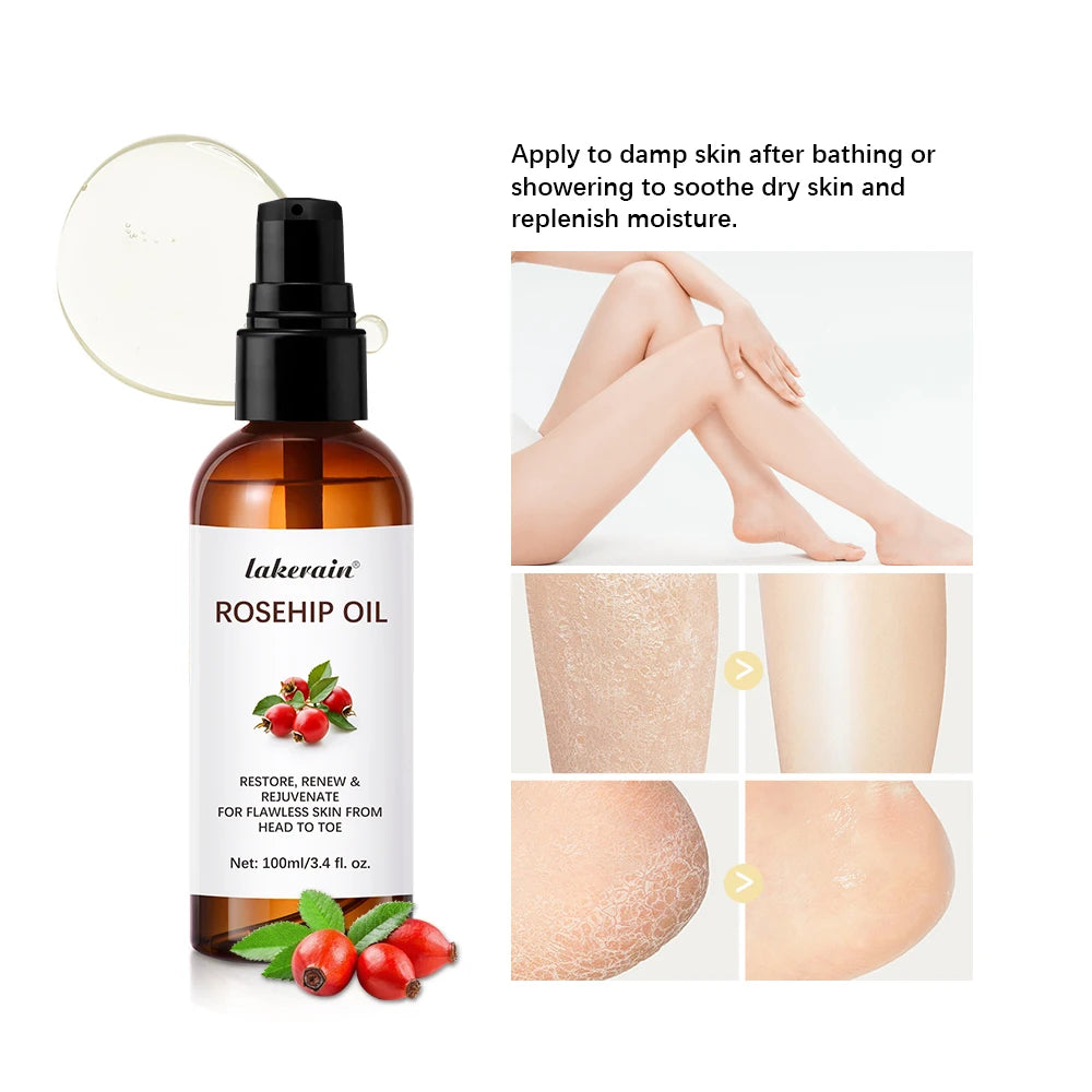 Organic Rosehip Oil 30ml – Face & Body Moisturizer with Retinol