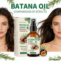 Batana hair care essential oil spray is rich in batana and rosemary ingredients to prevent dryness, hair care Oasis Select Default Title