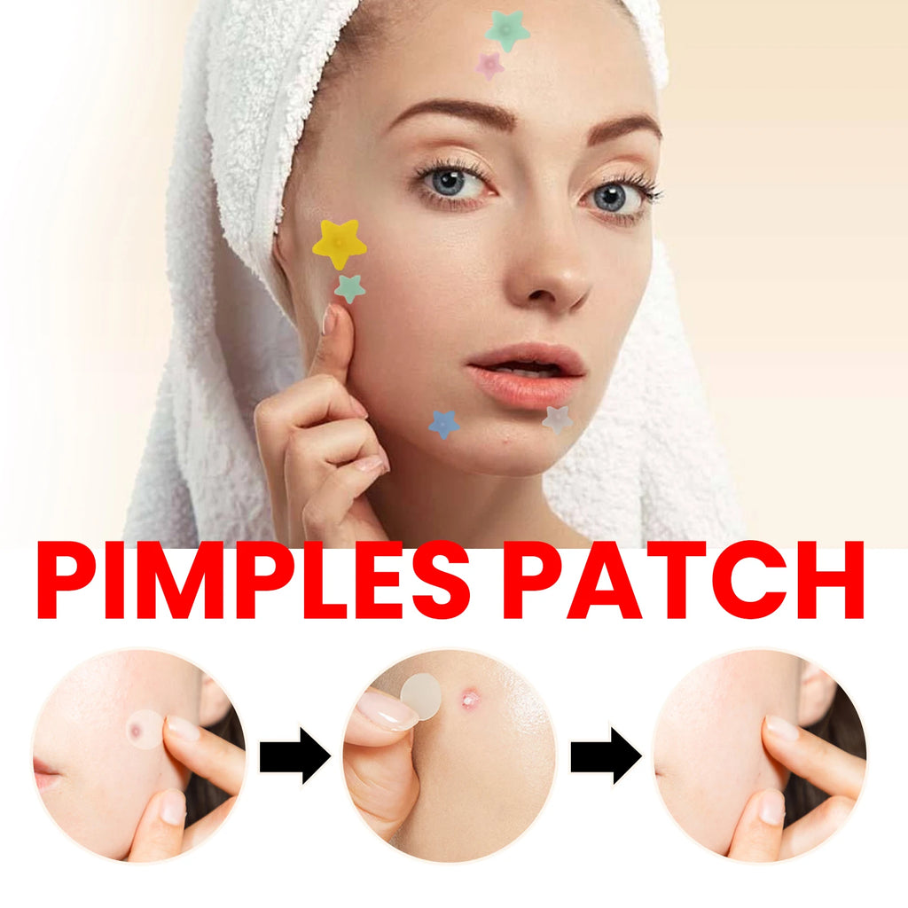 200Pcs Repair Acne Patch Fade Blemishes Pimple Marks Closed Acne Blemishes Hydrocolloid Star Shaped Cover Acne Pimple Patch Oasis Select
