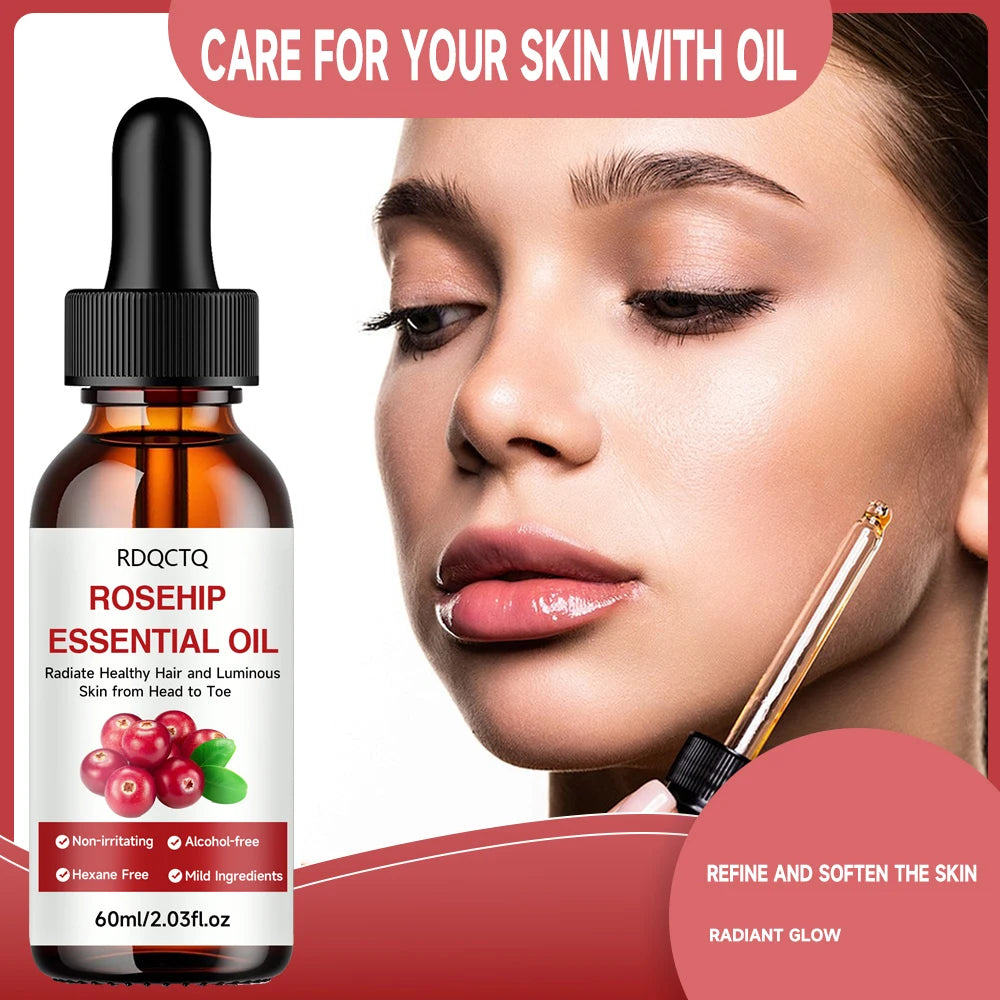 Rose Hip Oil for Hair & Skin - Pure Natural Moisturizing Essential Oil, Alcohol-Free, Nourishing Care for Healthy Look Oasis Select
