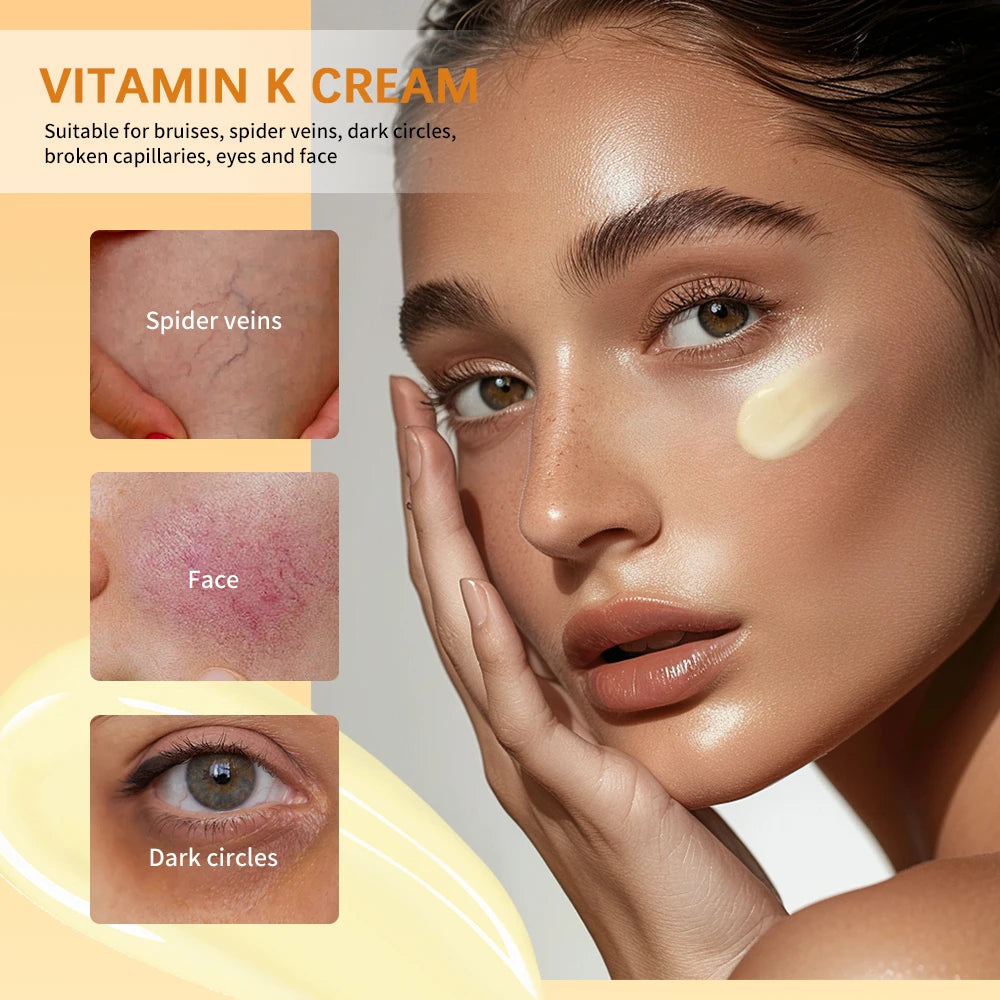 Vitamin K Cream Anti-aging And Wrinkle Removal Varicose Vein Relief Cream Massage Care Relieve Leg Soreness Swelling Ointment Oasis Select