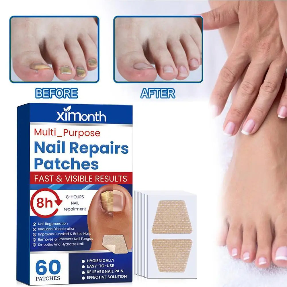 60pcs Toenail Patches Nail Repair Extra Strength Patches For Toenail Fingernail Non-Irritating And Breathable Nail Repair Oasis Select