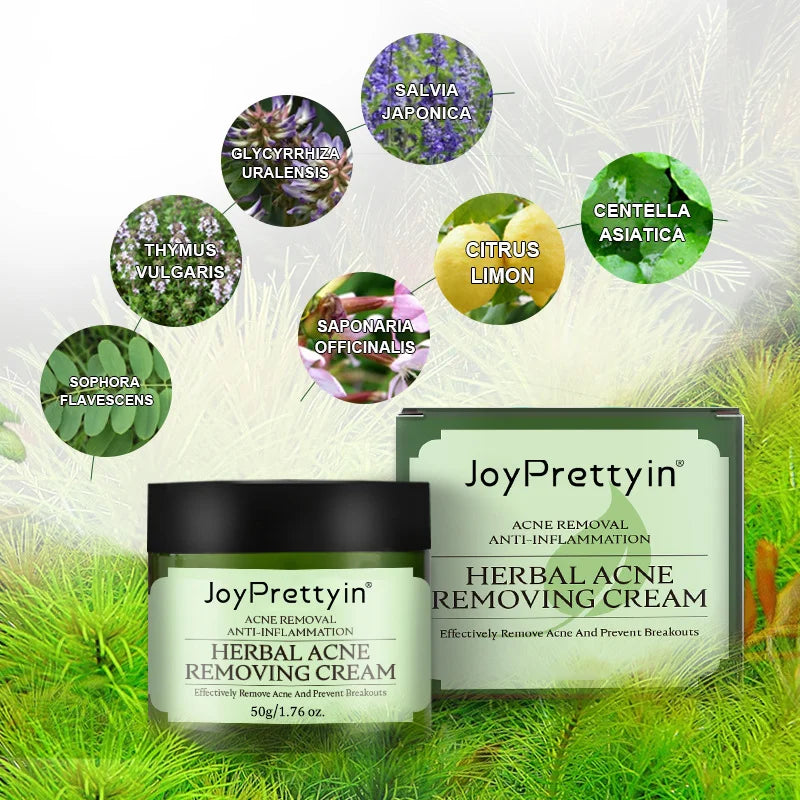 JoyPretty Herbal Acne Face Cream – Oil Control & Marks Removal Herbal Acne Cream Oasis Select