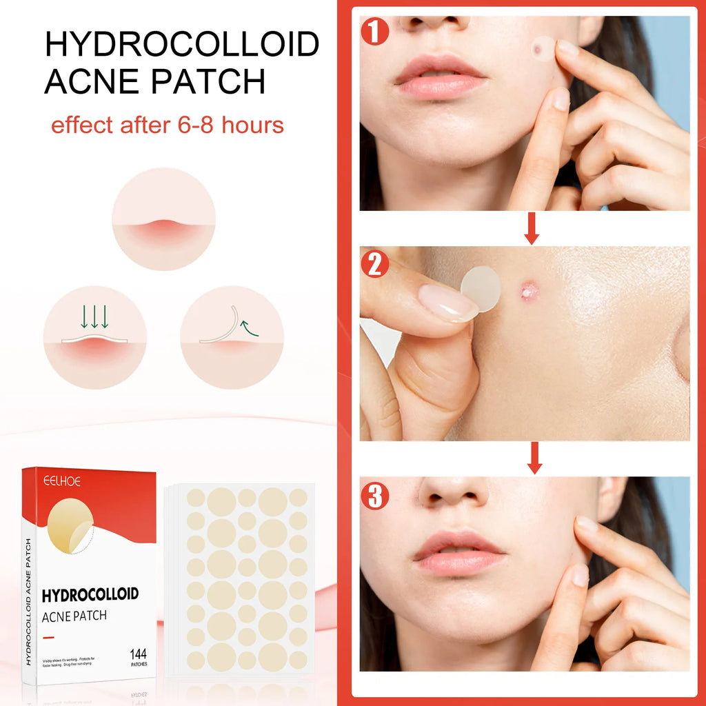 Hydrocolloid Acne Patch Facial Blemishes Pimple Marks Closed Acne Blemishes Cover Acne Pimple Repair Patch Invisible Acne Patch Oasis Select