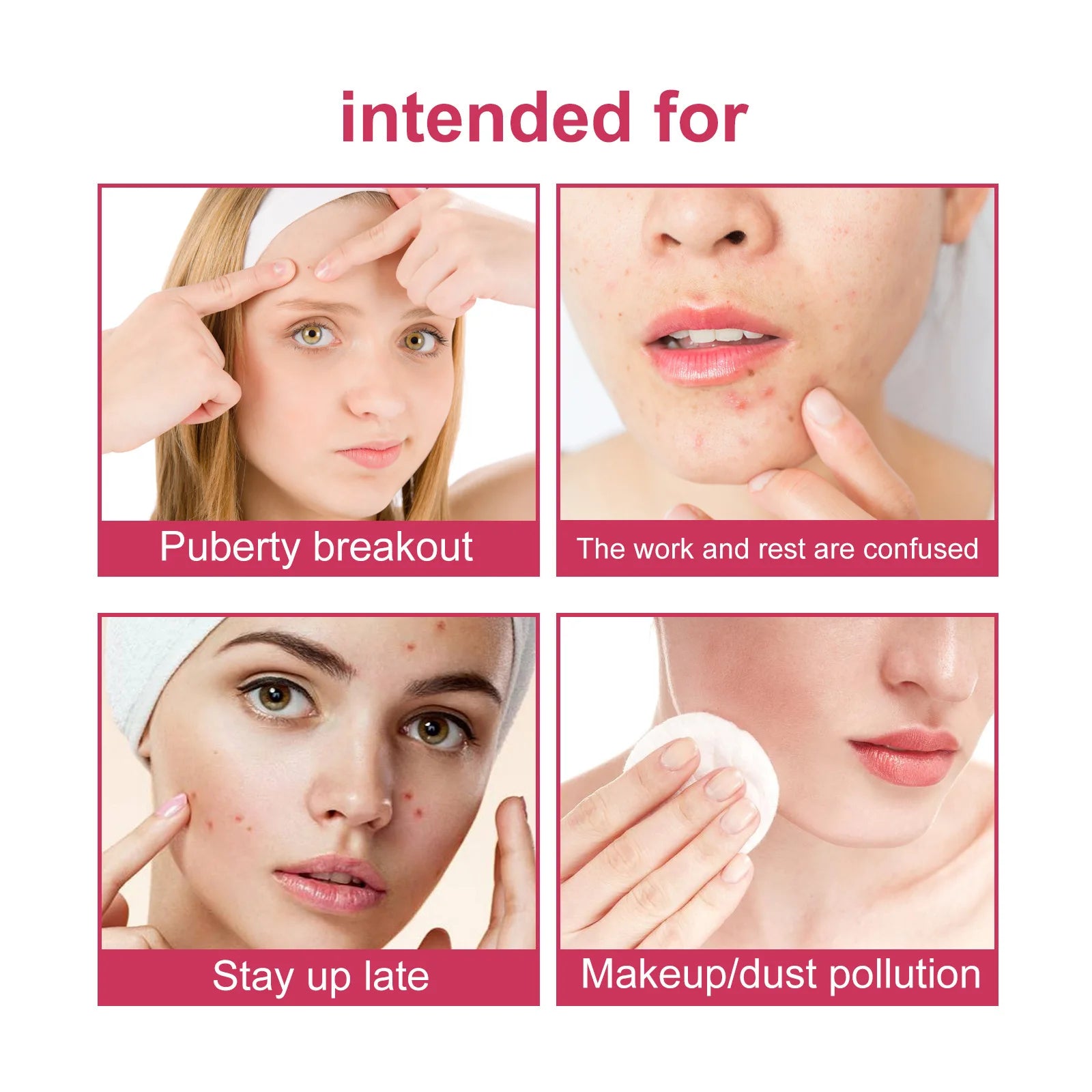 Wiieey Star Acne Patches – Colorful Pimple Stickers 144–288pc Acne Pimple Patch Oasis Select