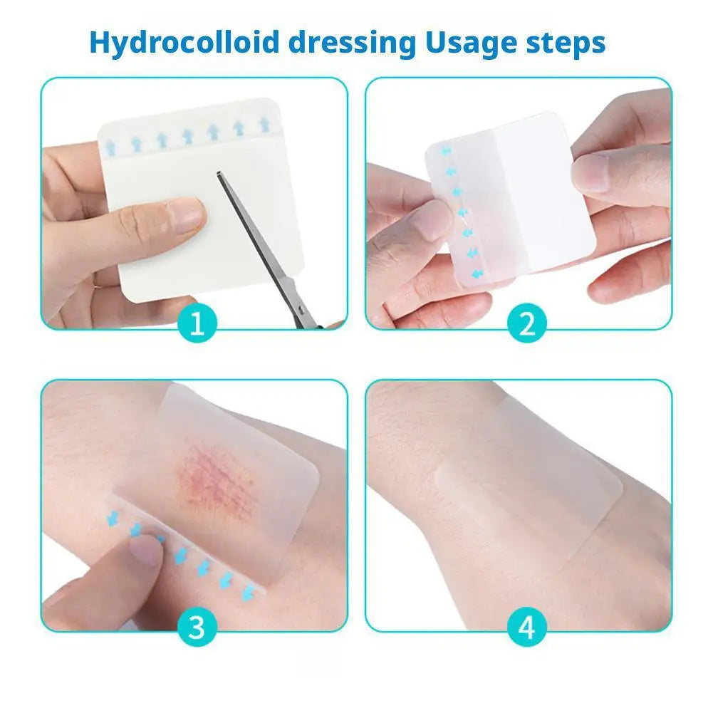 Hydrocolloid Bandage Roll – Waterproof Self-Adhesive Wound Dressing Hydrocolloid Wound Dressing Oasis Select