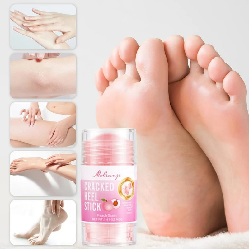 Peach Hand & Foot Cream – Moisturizes Dry & Cracked Skin