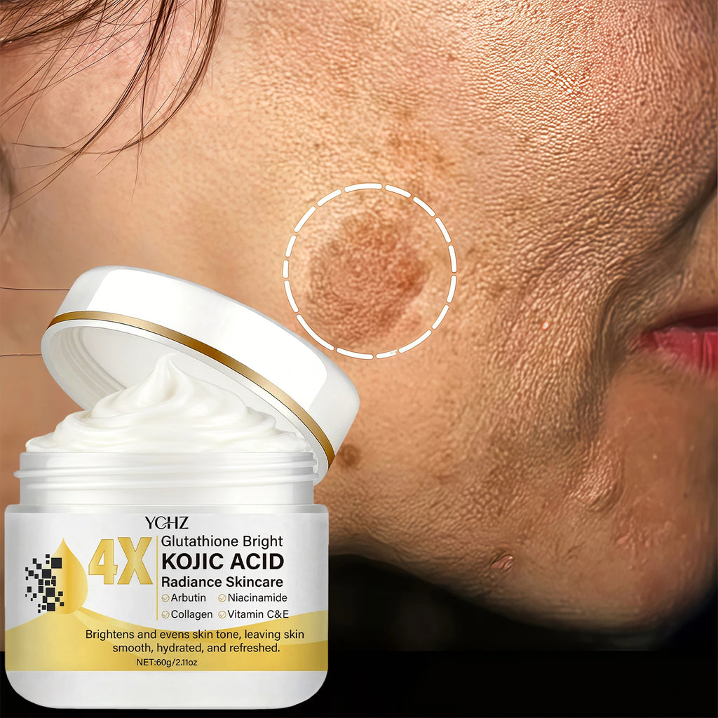 Kojic Acid Face Cream – Brightening & Dark Spot Corrector 60g