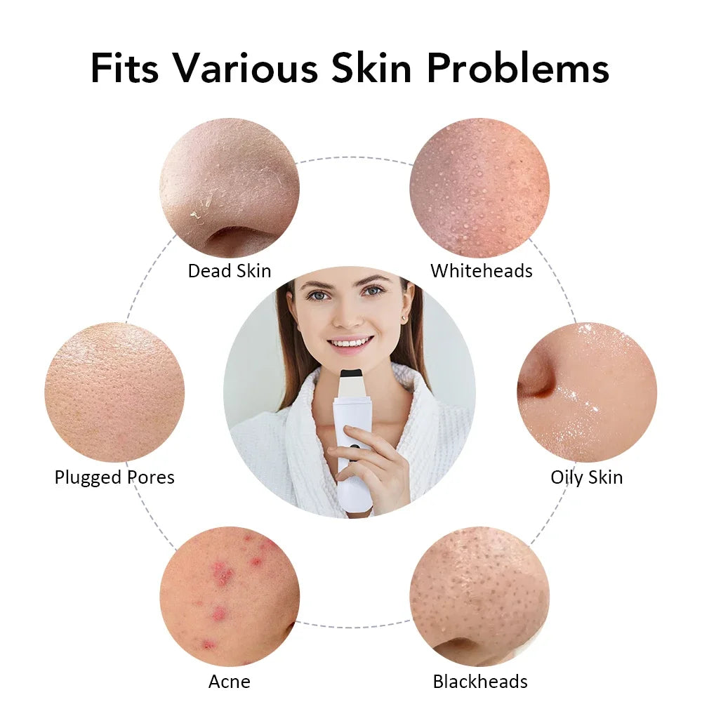 Ultrasonic Skin Scrubber – Blackhead & Deep Pore Cleanser