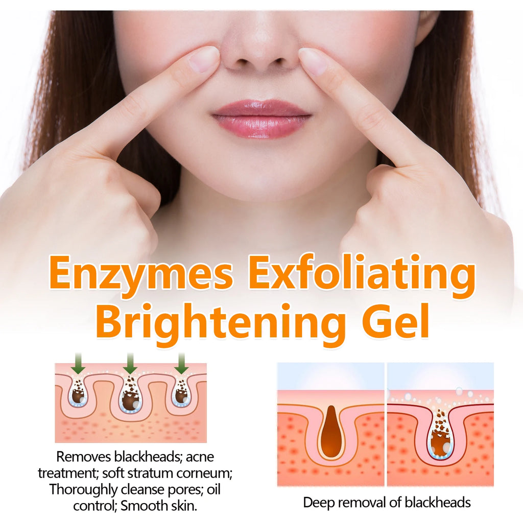 Enzymes Exfoliating Brightening Gel Salicylic Acid Blackhead Dead Skin Remover Cleansing Shrink Pores Brightening Delicate Skin Oasis Select