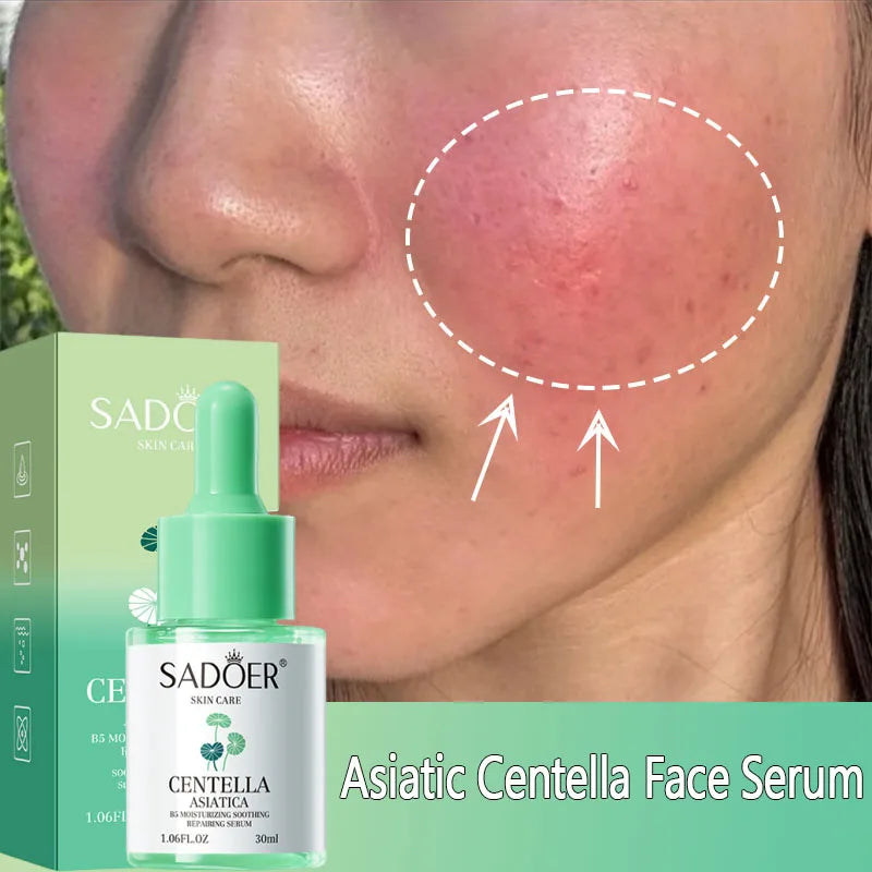 SADOER Centella Asiatica Face Serum – Brighten & Firm Skin Face Serum Oasis Select