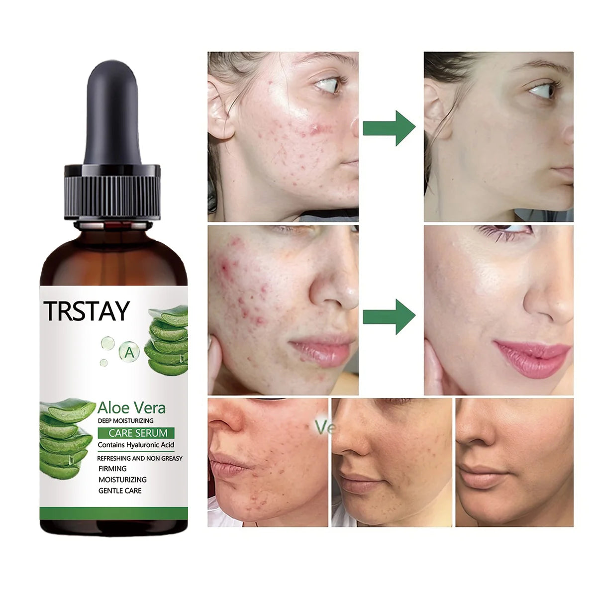 Aloe Vera Vitamin E Face Serum – Brighten & Hydrate Skin
