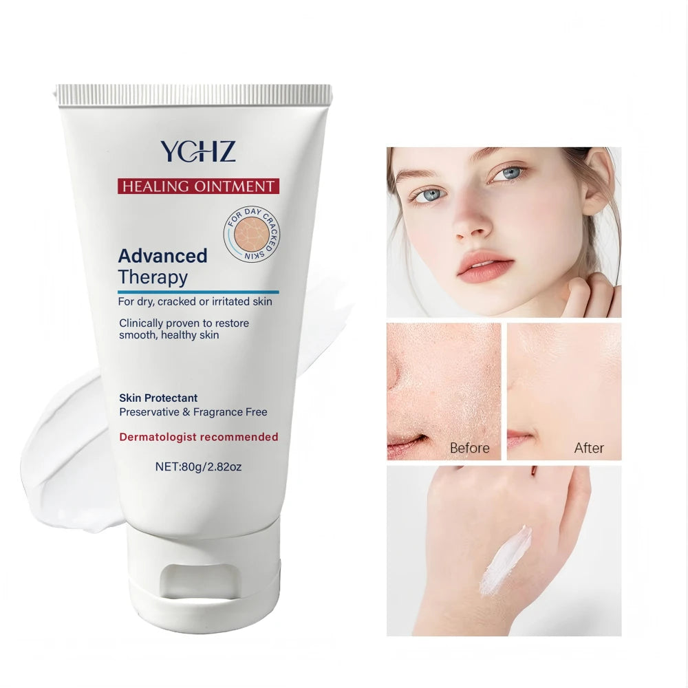 YCHZ Hydrating Body Cream – Shea Butter, Vitamin E & Hyaluronic Acid