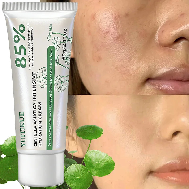 YUITIKUE Centella Asiatica Hydration Cream – Sensitive Skin