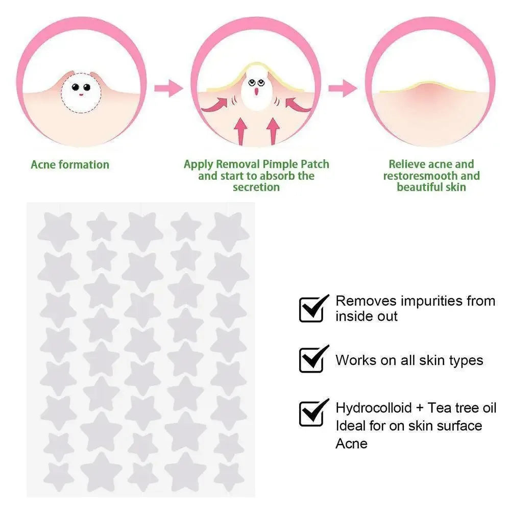 40pcs/120pcs Colorful PE Pimple Patches Cute Star Shaped Pimple Cover Sticker Invisible Pimple Cover Removal Pimple Patch Oasis Select