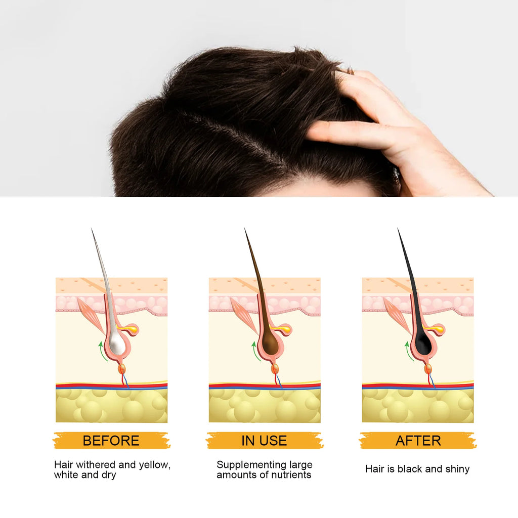 East Moon He Shou Wu Hair Darkening Shampoo Bar | Gray Hair Hair Darkening Shampoo Bar Oasis Select