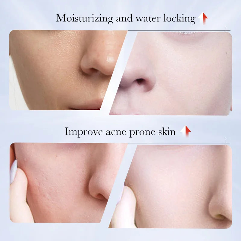 SADOER Kojic Acid Facial Cleanser – Oil Control & Brightening Foaming Facial Cleanser Oasis Select