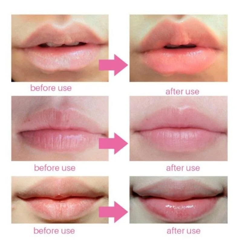BIOAQUA Cherry Gollagen Hydrating Lip Mask Moisturizing Nourishing Anti-Drying Lightening 20pcs Oasis Select