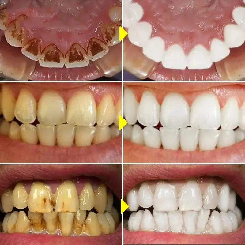 V34 Whitening Toothpaste 2-Pack | Stain Removal & Fresh Breath