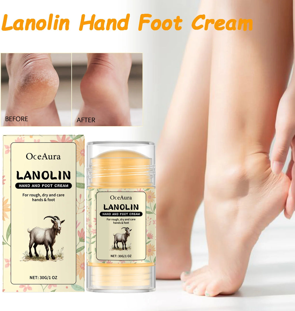 Lanolin Hand Foot Stick For Dry Cracked Rough Skin Gentle Moisturizing Nourishing Anti Crack Preventing Your Feet From Cracking Oasis Select