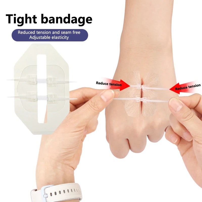Emergency Wound Closure Zip Stitch Sutures Bandaids Repair Wounds Without Stitches For Outdoor Activities Quick Clot Wound Oasis Select