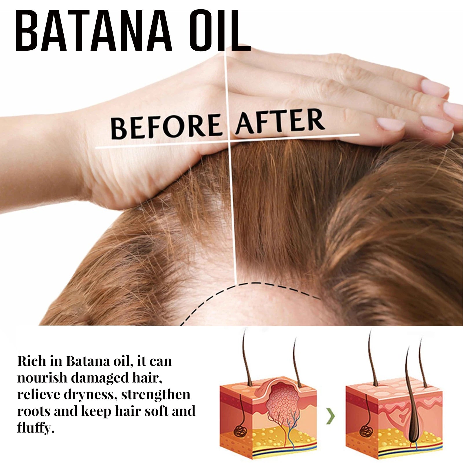 Batana Oil Hair Growth Spray – Anti Hair Loss Treatment 30ml Hair Growth Spray Oasis Select