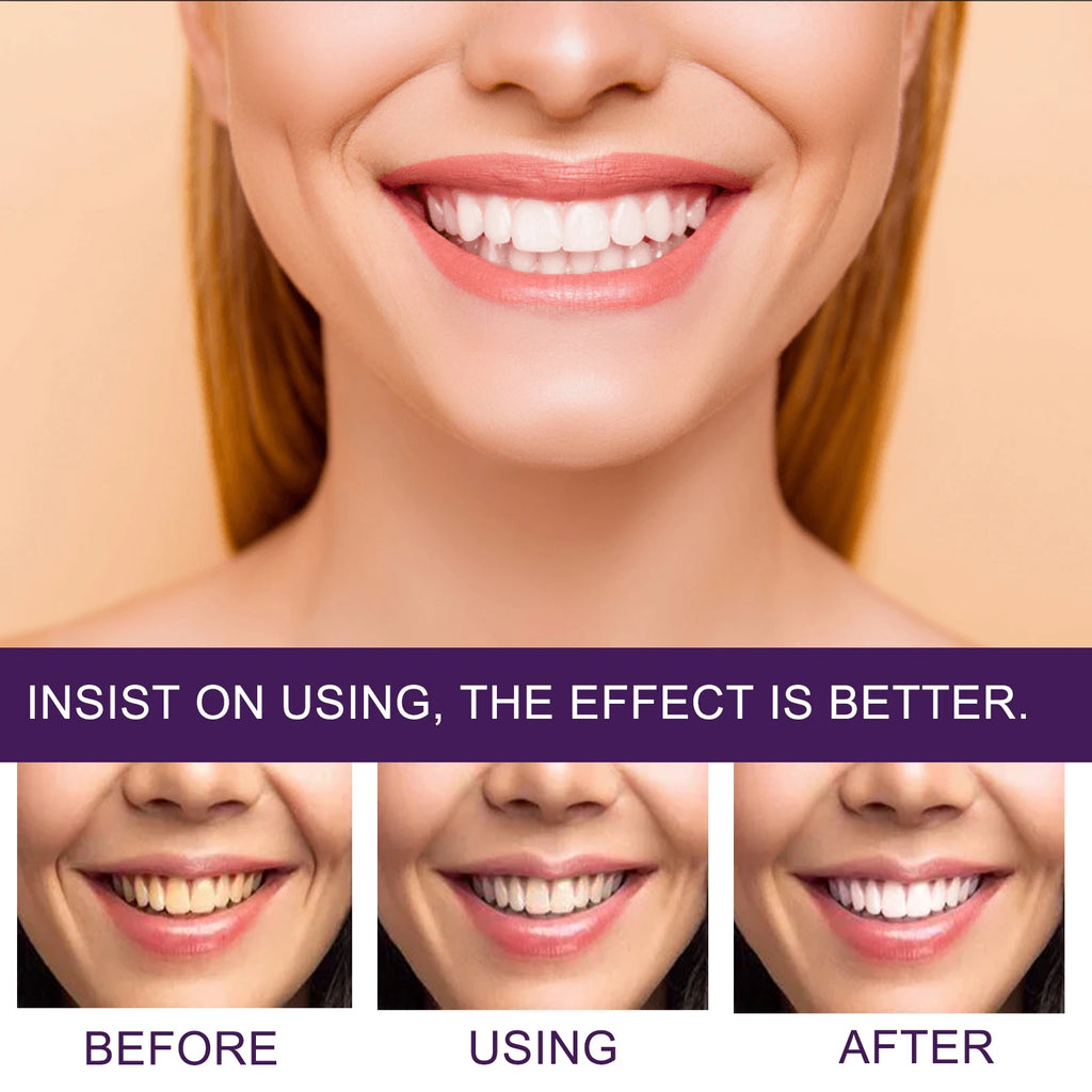 v34 Purple Toothpaste Teeth Whitening & Stain Removal Prevents Yellowing Brightens for Radiant Smiles Breath Oral Oasis Select