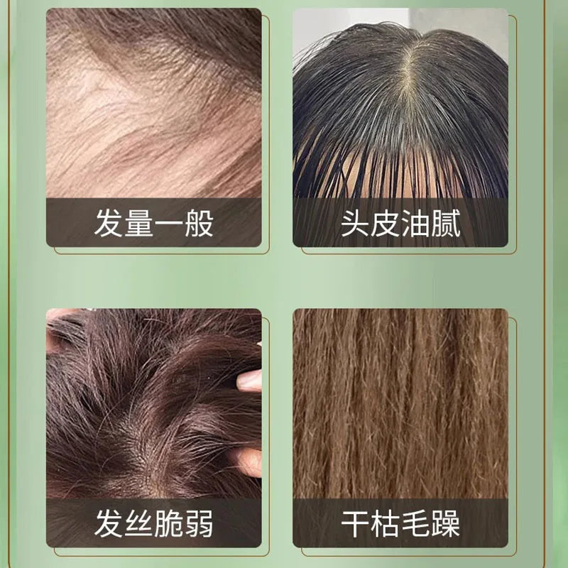 Herbal Hair Strengthening Nourishes Shampoo 380ml - Scalp Care Oil Control Reduces Breakage for Fuller, Healthier-Looking Hair Oasis Select