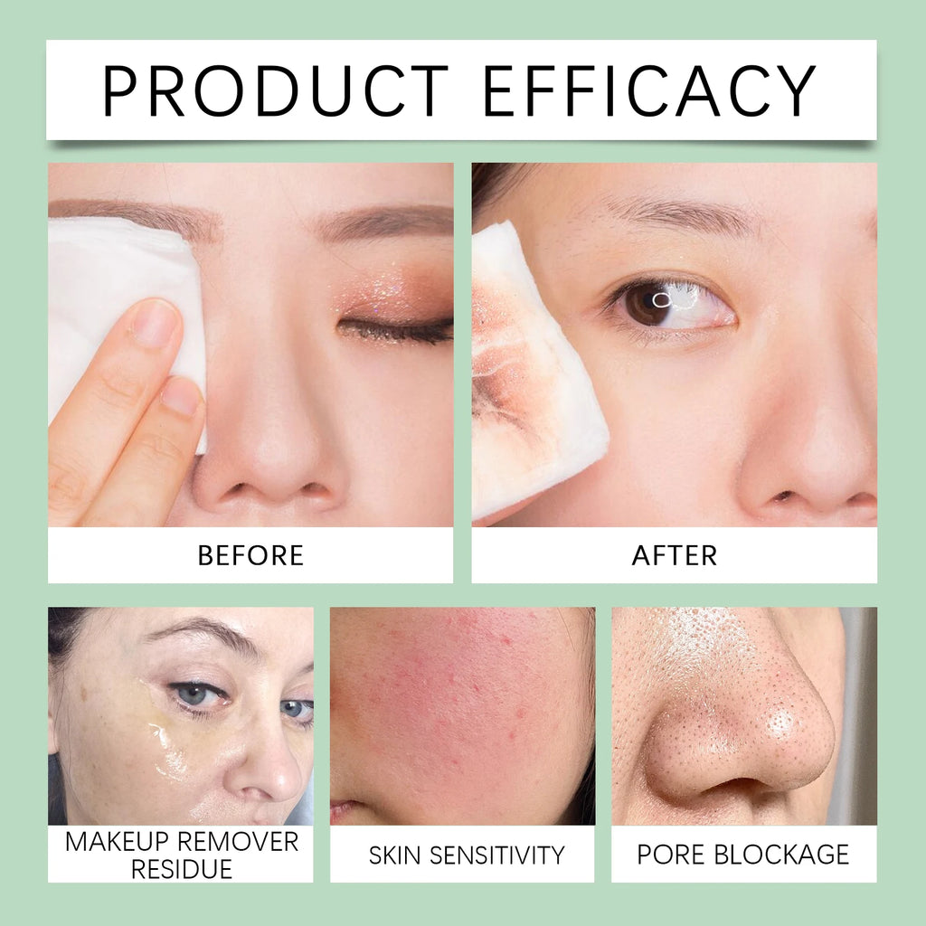 Eelhoe Cica Cleansing Oil – Makeup Remover & Pore Cleanser Facial Cleansing Oil Oasis Select