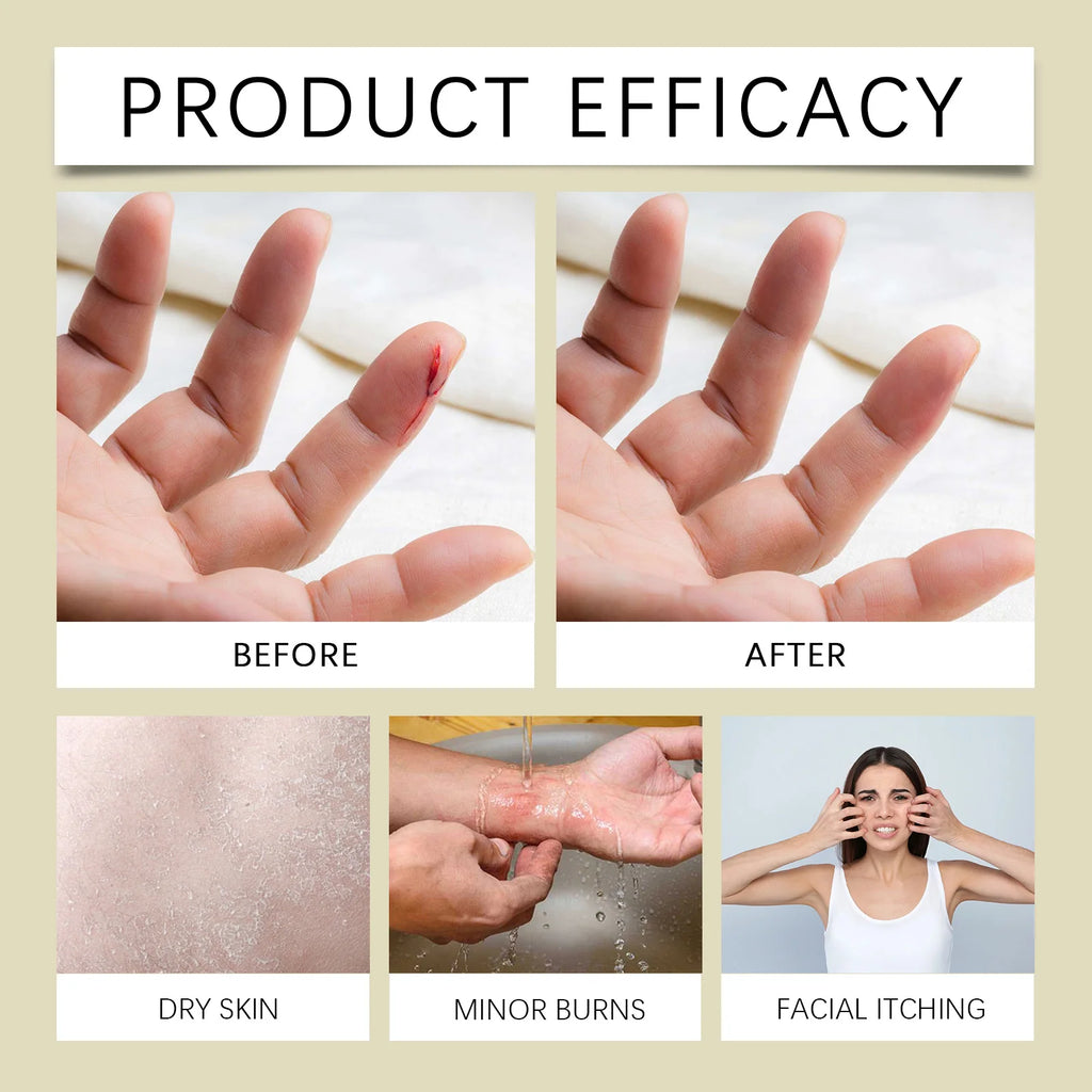 Moisturizing Whipped Tallow Balm Dry Sensitive Skin Long Lasting Hydration Gentle Tallow Cream Body Face Care Winter Moisturizer Oasis Select