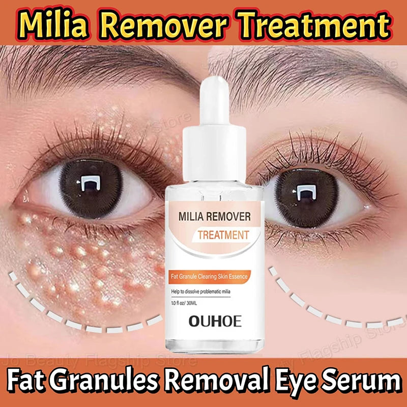 Milia Eye Serum – Firming, Brightening & Moisturizing Skin Care