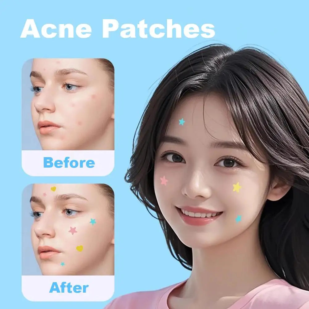 Colorful Star & Heart Acne Patches – 420 to 1260 Pcs Acne Patch Stickers Oasis Select