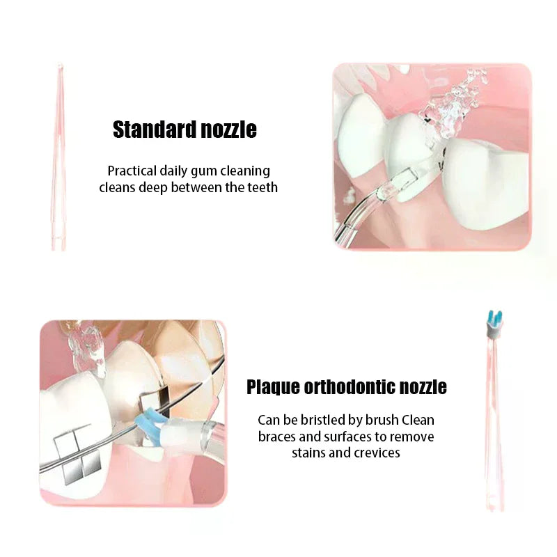 4 Pcs/Set Replaceable Oral Dental Nozzles For Oral Irrigator Dental Water Jet Mouthwash Flosser Oasis Select