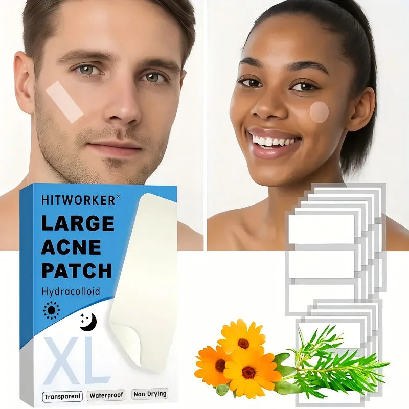 30 pieces/box transparent long strip hydrocolloid concealer stickers - day and night universal, face concealer concealer sticker Oasis Select
