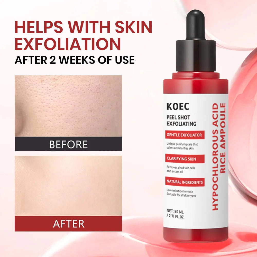 80ml Rice Peeling Lotion Oil with Hypochlorous Acid Exfoliating Bleaching Dark Skin Whitening Nourishing Moisturizing Skin Care Oasis Select