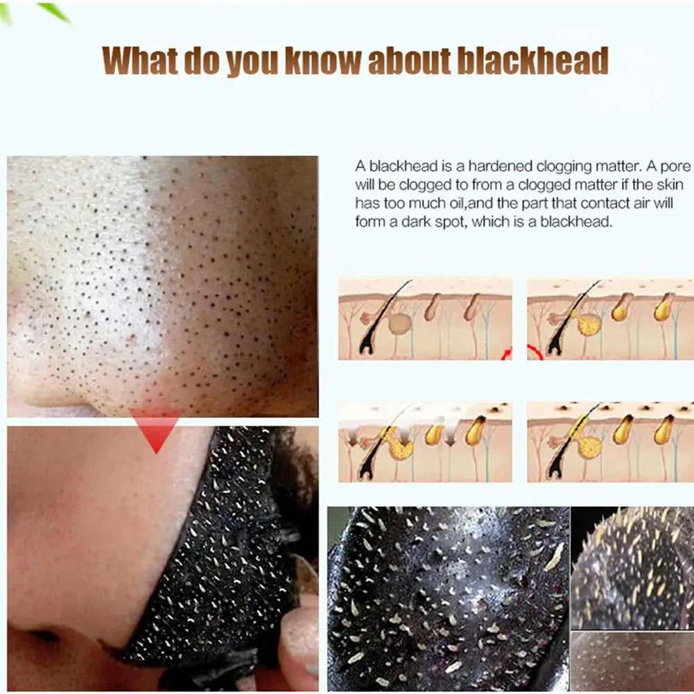 Efero Plant Extraction Blackhead Remover Mask Deep Cleansing Shrink Pores Tighten Skin Suitable for All Skin Types Oasis Select