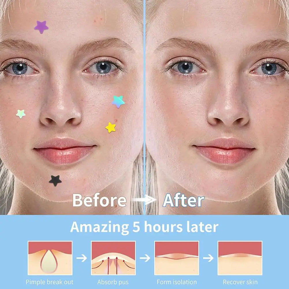 Colorful Hydrocolloid Dots Cute Star Heart Shaped Acne Pimple Patch For Face Invisible Zits & Blemishes Cover Stickers Skin Care Oasis Select