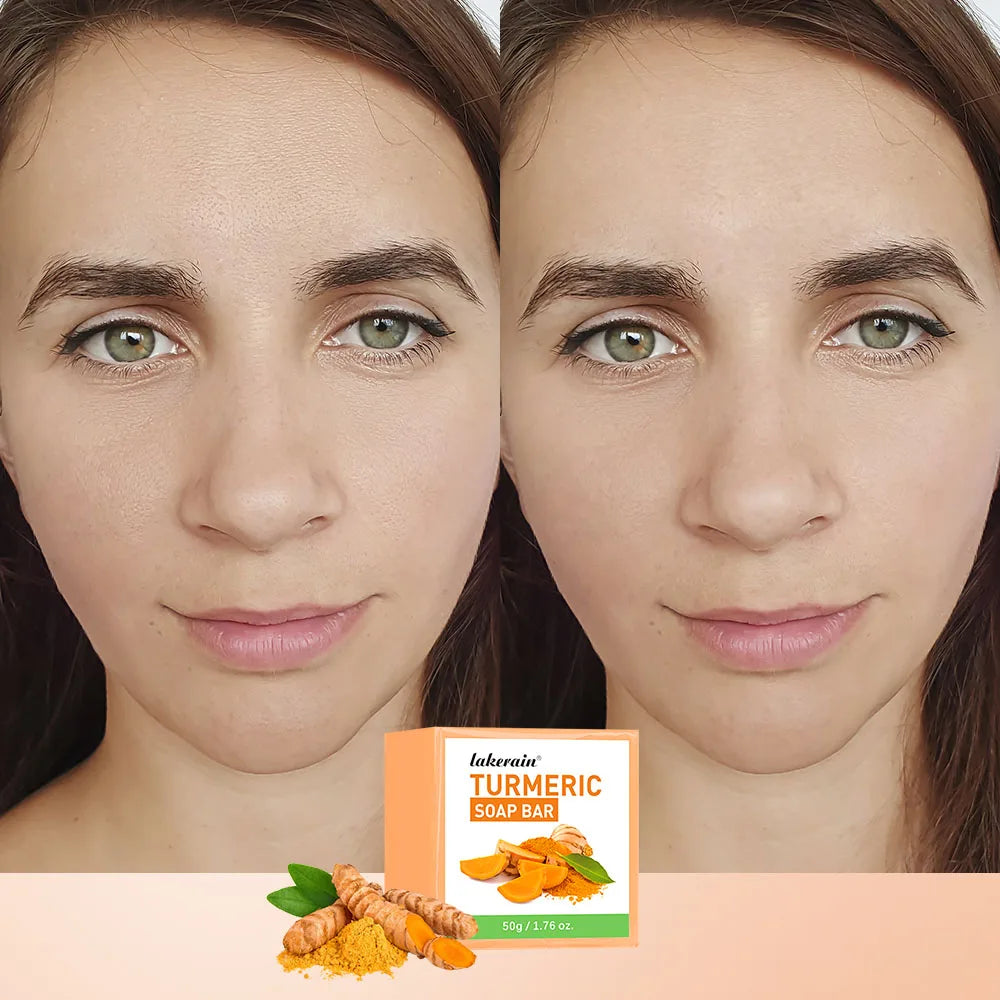 Turmeric Lemon Acids Kojic Acid Soap Handmade Natural Skincare Bar for Moisturizing Exfoliating Body and Face Oasis Select