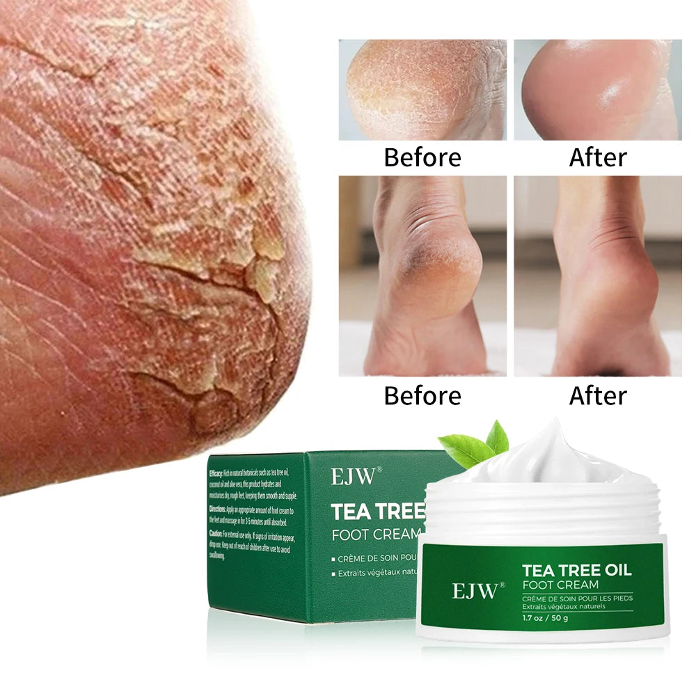 Tea Tree Oil Foot Cream, Warming Cream - Calluses, Dry Cracked Feet, Hands, Heels, Elbow -Softens & Moisturizes Skin, Foot Balm Oasis Select