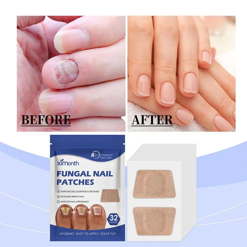1-3Pcs Fungal Nail Treatment Patch Paronychia Anti-Infection Onychomycosi Removal Grey Nail Repair Correct Ingrown Nail Sticker Oasis Select
