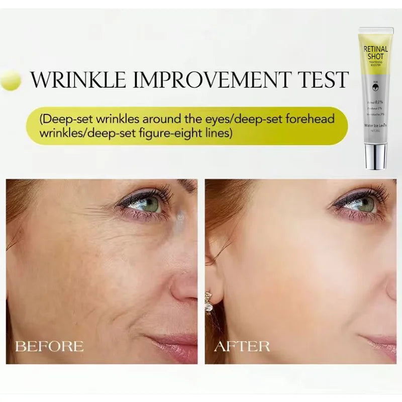 Retinal Eye Serum – 0.1% Retinal & 3% HA for Firm, Smooth Eyes Eye Serum Oasis Select