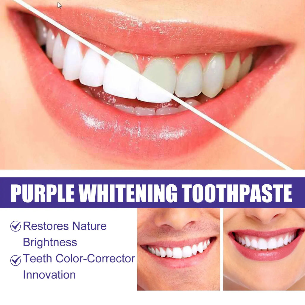 Purple Toothpaste Teeth Whitening Remove Yellow Stains Fights Tartar Fresh Breath Oral Hygiene Teeth Care Cleaning Toothpaste Oasis Select